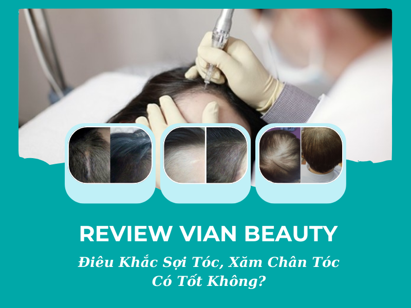 Review Vian Beauty 1