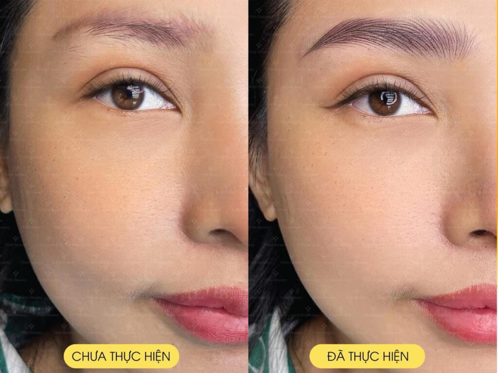 Phun Xăm Mày Môi Ở Vian Beauty: Lột Xác Nhan Sắc An Toàn? 4 Vian Beauty có khả năng xử lý tốt mọi trường hợp khó về chân mày