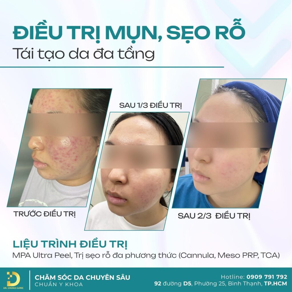 khach hang tri seo mun seo ro dr choice