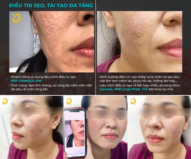 khach hang tri seo ro 5in1 dr choice