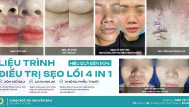 anh 1 tri seo loi 4 in 1 1