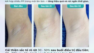 tri tham nach dr choice