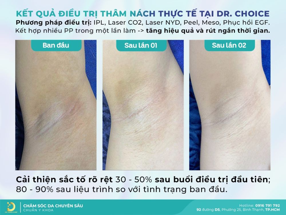 tri tham nach dr choice